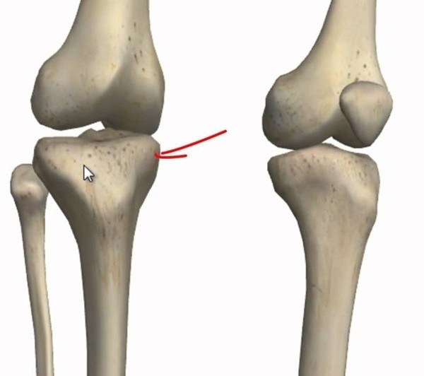 ▲ 관절염은 관절의 손상을 수반하는 것을 특징으로 하는 질환이다.